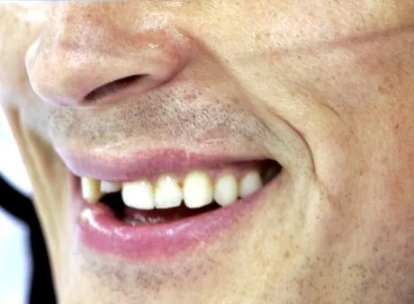 Teemu Selänne